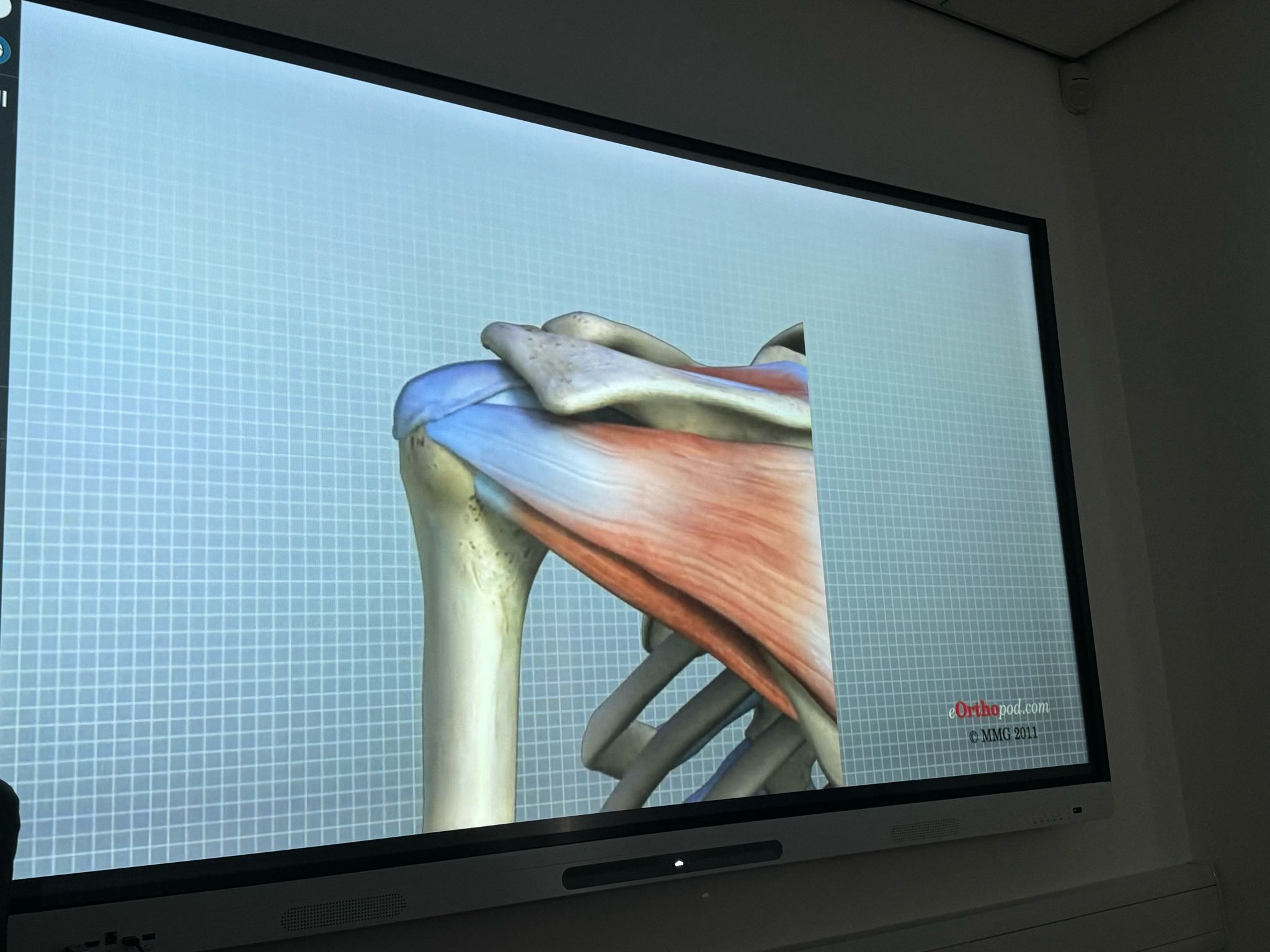 Anatomical shoulder illustration in MediCenter Bolton meeting room for medical conference.